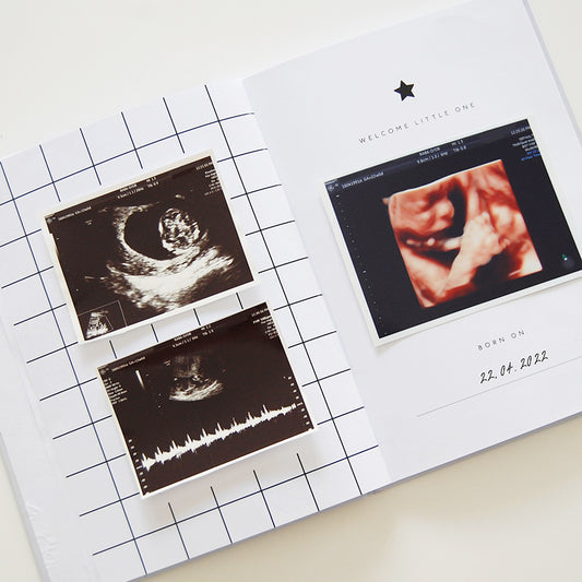 Baby journal footprint page with clean-touch ink pad and tiny foot imprint